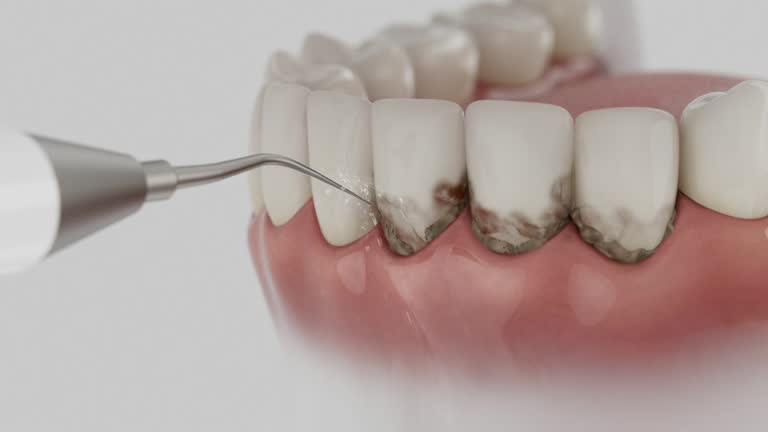 Trusted Emergency Dentist service in Portland, IN - Dentist Open Now